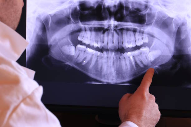 Best Cracked Tooth Emergency Dentist  in Neah Bay, WA